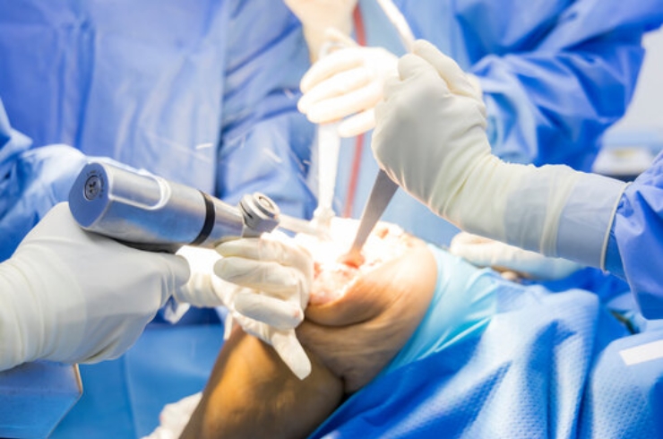 Joint replacement
